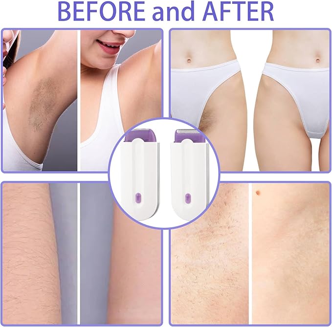 "FemmeFresh™ DEPILADORA FACIAL MULTIFUNCIONAL